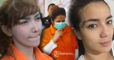 6 Selebriti yang Wajahnya Berubah Drastis Jadi Menyeramkan Karena Narkoba