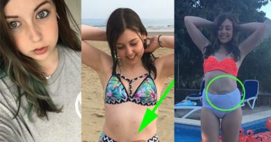 Kisah Memilukan Dibalik Cewek Viral Sering Unggah Foto Pakai Bikini