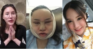 Seorang Gadis Thailand Bagi Foto Transformasi Wajahnya jadi Cantik