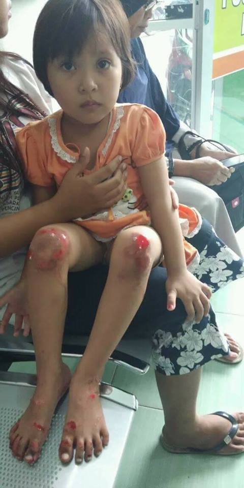 Tega, Diduga Depresi Ibu Kandung Seret Gadis 5 Tahun Pakai Motor