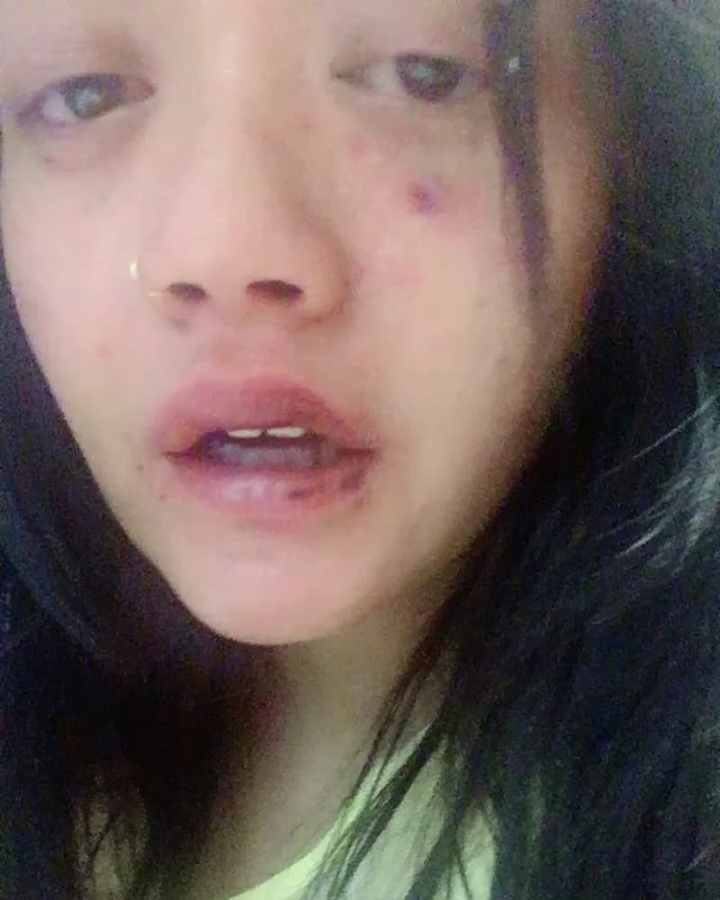 Kisah Model asal Indonesia Dylan Sada yang Dianiaya di AS