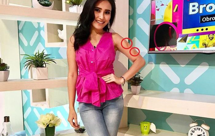 Lengan Ayu Ting Ting Memar Karena Dibanting di Acara Televisi