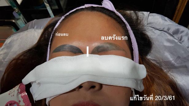 Niat Tampil Cantik Dengan Sulam Alis, Gadis Syok Lihat Hasilnya