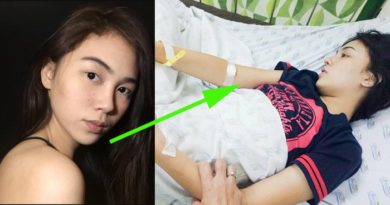 Wanita Cantik Ini Benci Air Putih & Selalu Minum Jus, Akibatnya Jadi Sangat Mengerikan