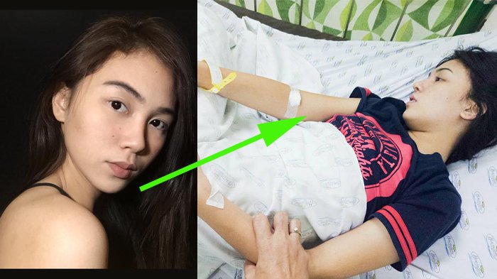 Wanita Cantik Ini Benci Air Putih & Selalu Minum Jus, Akibatnya Jadi Sangat Mengerikan