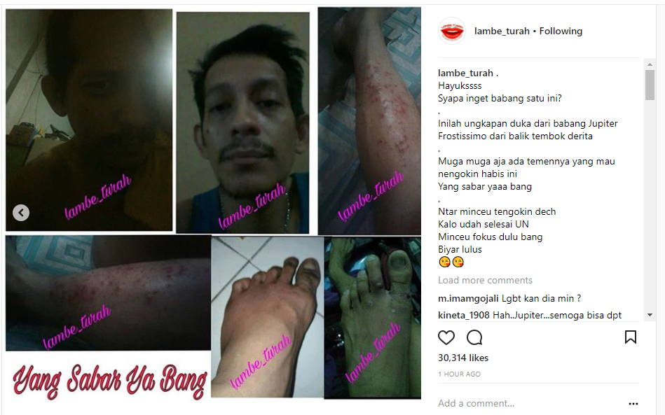 Kondisi Jupiter Fortissimo Setelah Dua Tahun di Penjara Memilukan!