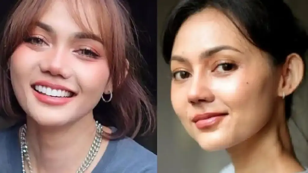 Artis Komedian Rina Nose Operasi Hidung dengan Dokter Tompi Menjadi Sorotan Publik