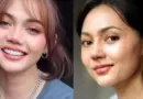 Artis Komedian Rina Nose Operasi Hidung dengan Dokter Tompi Menjadi Sorotan Publik