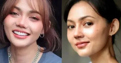 Artis Komedian Rina Nose Operasi Hidung dengan Dokter Tompi Menjadi Sorotan Publik