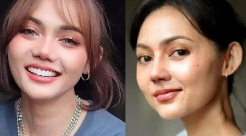 Artis Komedian Rina Nose Operasi Hidung dengan Dokter Tompi Menjadi Sorotan Publik