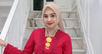 YouTuber Ria Ricis Operasi Hidung Padahal dari Keluarga Islami yang Tau Hukum Oplas