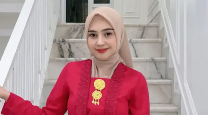YouTuber Ria Ricis Operasi Hidung Padahal dari Keluarga Islami yang Tau Hukum Oplas
