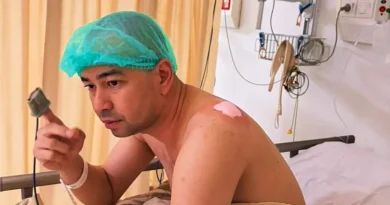 Aktris Raffi Ahmad Buka Suara Soal Kesehatan Benjolan di Bahu