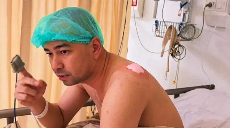 Aktris Raffi Ahmad Buka Suara Soal Kesehatan Benjolan di Bahu