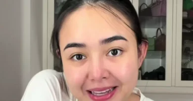 Baby Zac Disunat Setelah Lahir, Amanda Manopo Bicara Hasilnya
