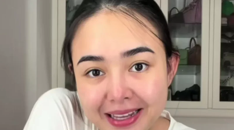 Baby Zac Disunat Setelah Lahir, Amanda Manopo Bicara Hasilnya