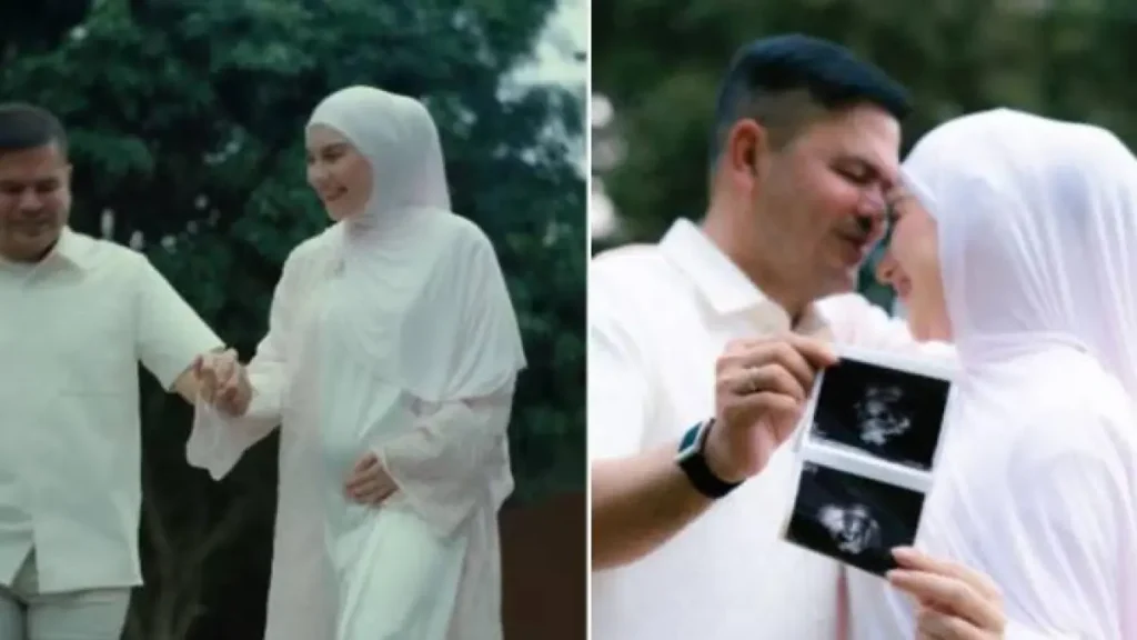 Rahasia Perjalanan Hamil Irish Bella, Ternyata Jalani Bayi Tabung